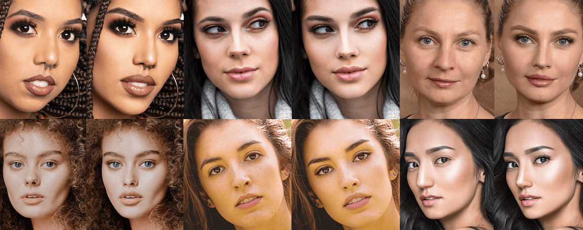 Plastic Surgery Visualization & Simulation Before & After Photos.
