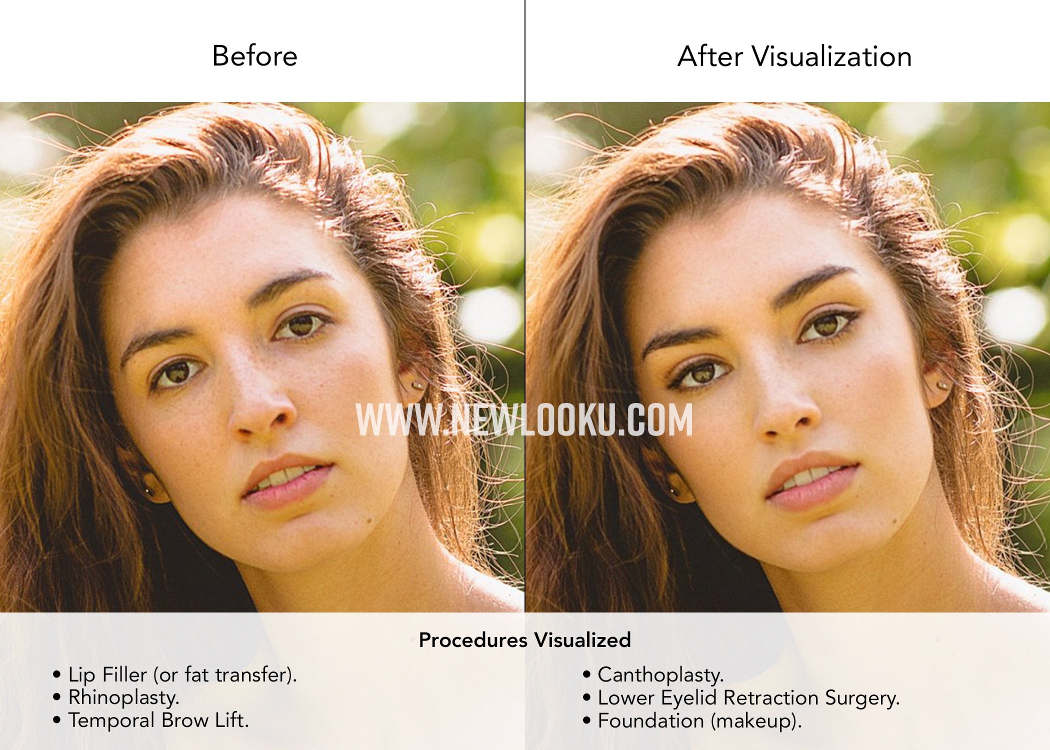 Young woman Plastic Surgery Simulation Service Before & After Photo.