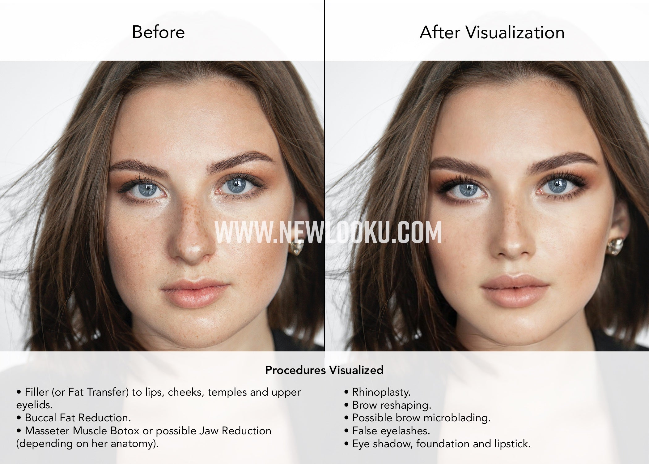 Female Plastic Surgery Simulation Service Before & After Photo.