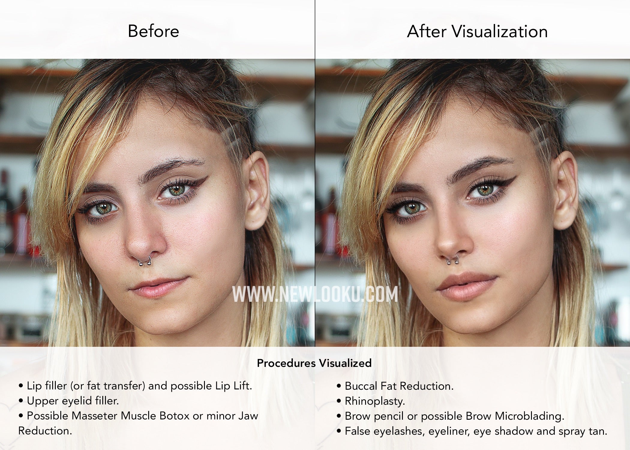 Young Woman Plastic Surgery Visualization Before & After Photo.