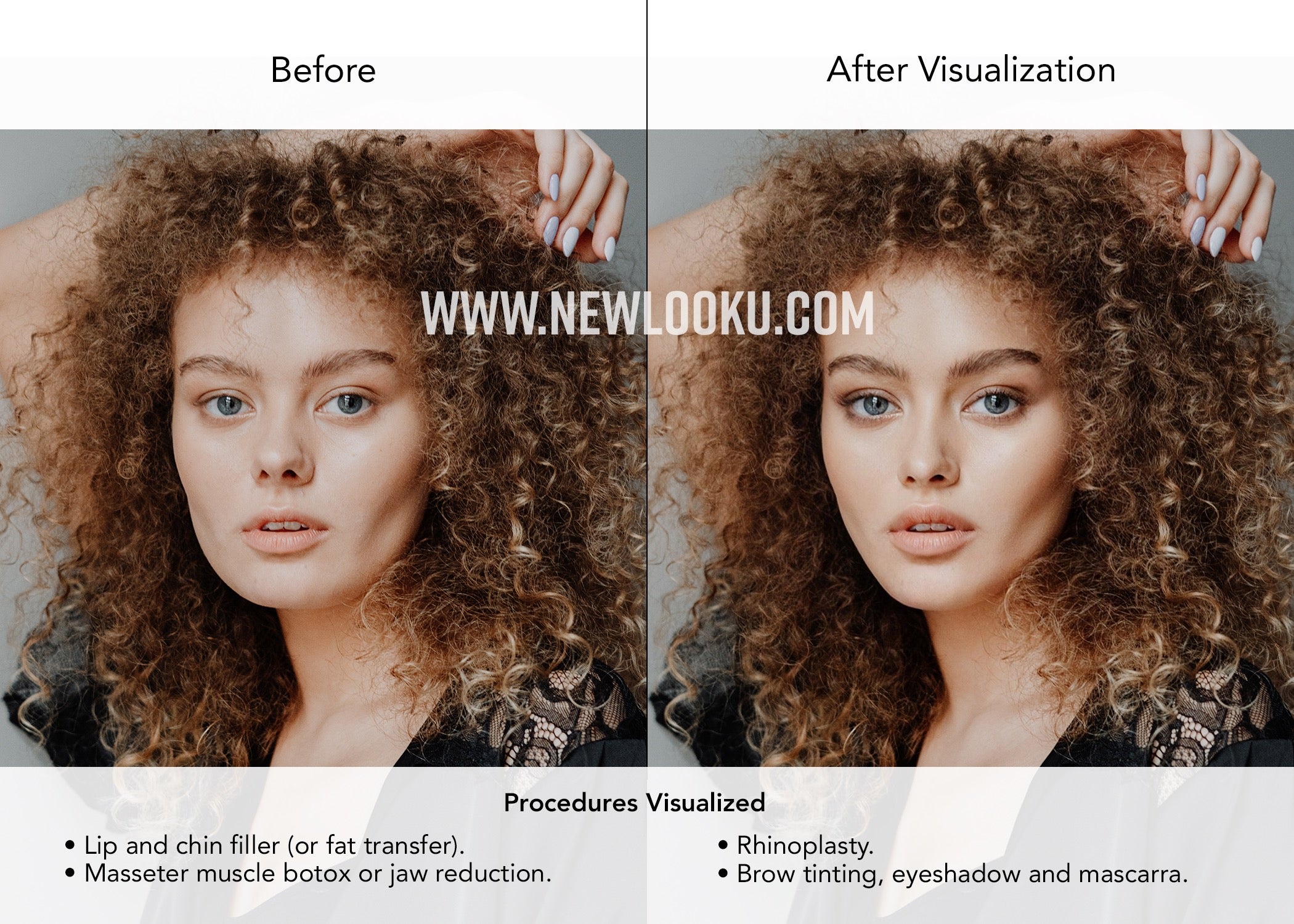 Young Female Plastic Surgery Simulation Before & After Photo.