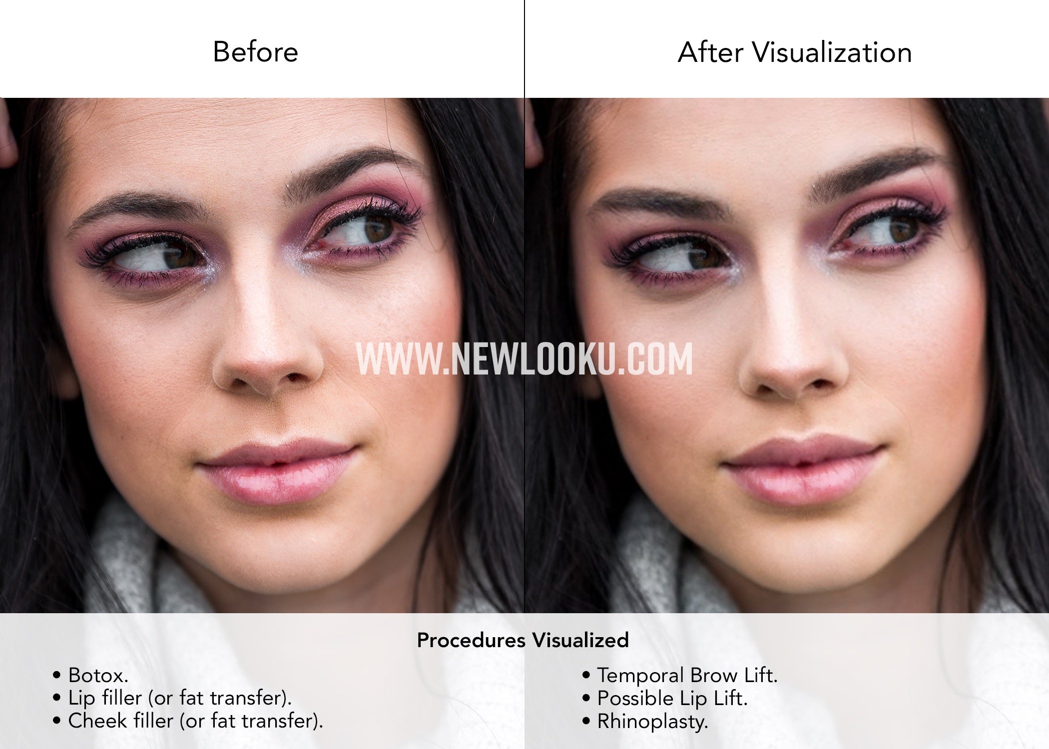 Plastic Surgery Visualization Before and After 