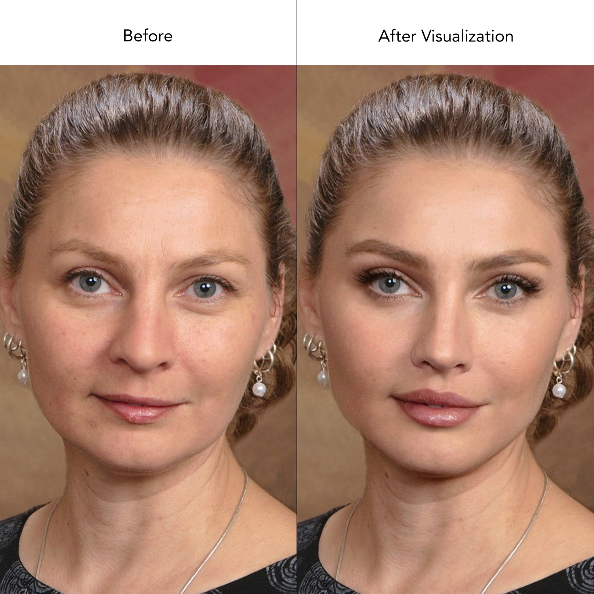 Plastic Surgery Visualization Before and After Photo - Ultimate Service